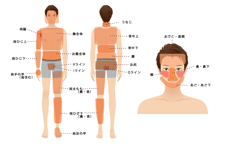 メンズ 美肌光脱毛